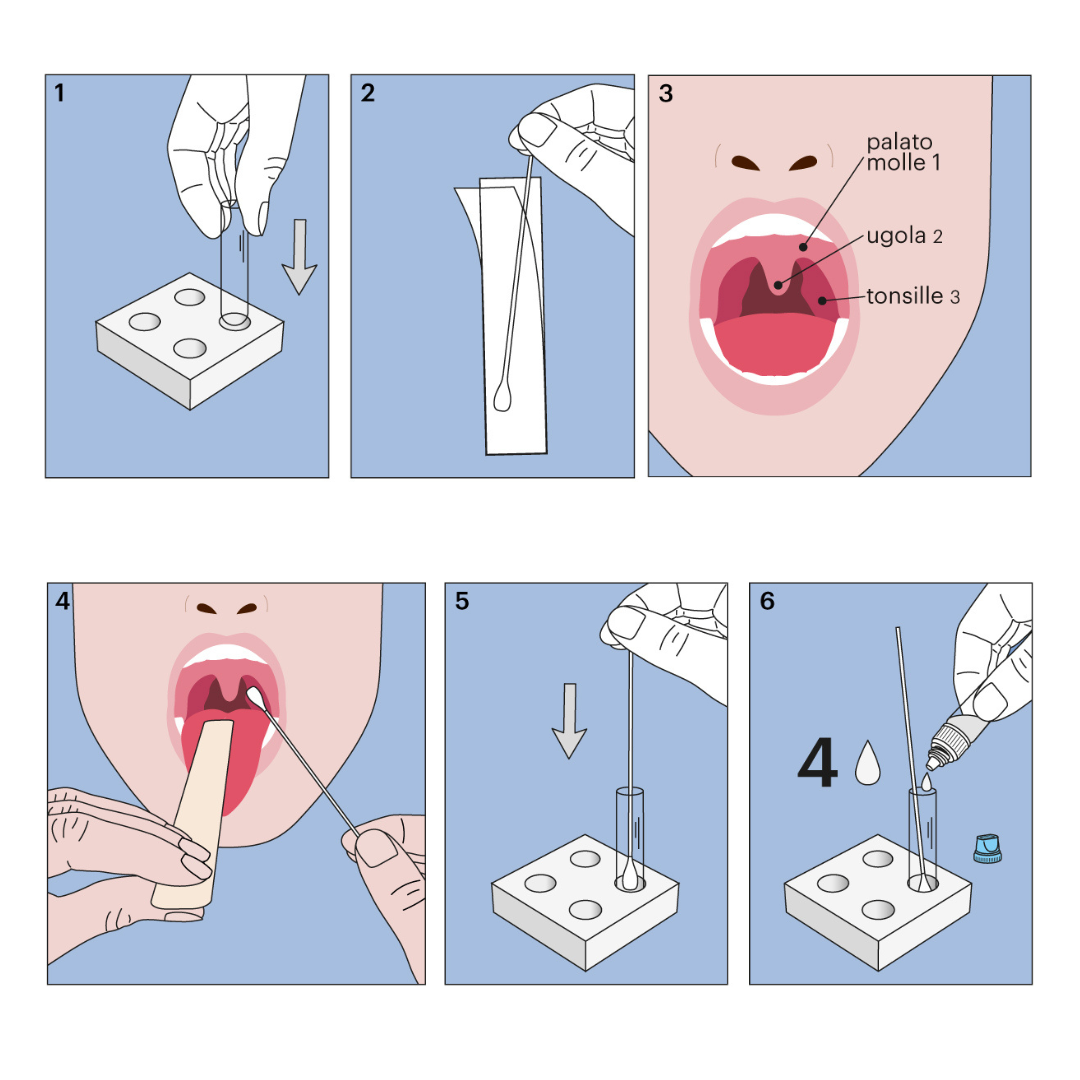 Test Helicobacter Pylori - Infezioni - Diagnosti.care